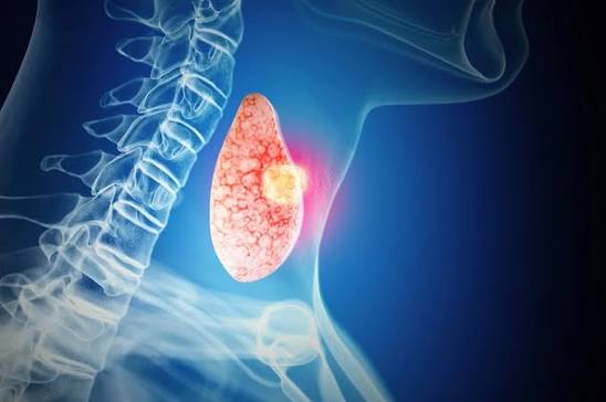 How Is Thyroid Cancer Treated?